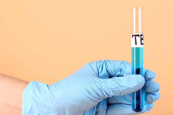 TB-500 Dosage in Research